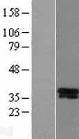 DLX5 Protein (Over-Expression Lysate Myc-DDK (Flag))