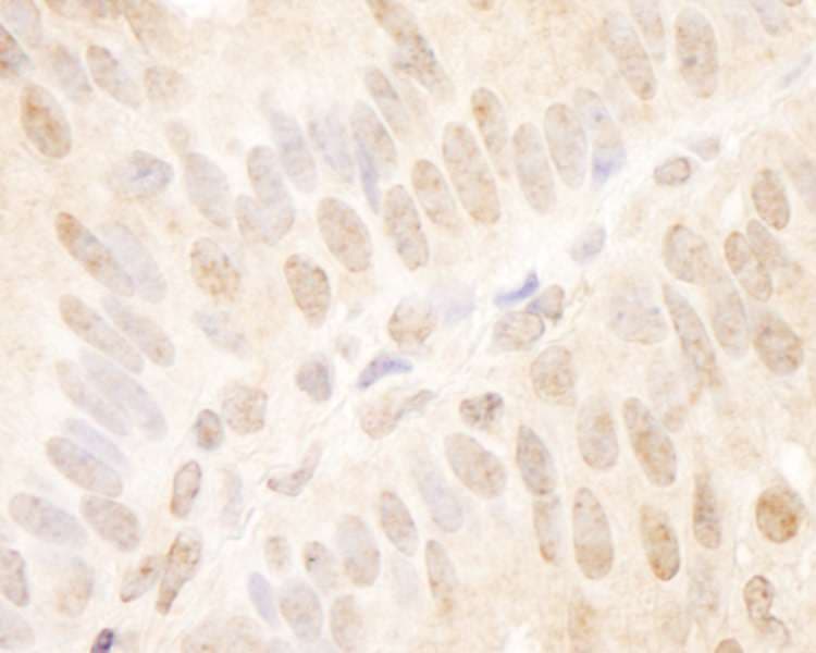 TCF12 / HEB Antibody (aa1-50)