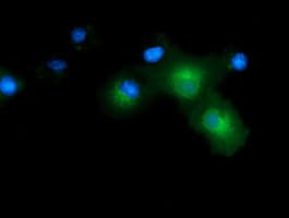Monoclonal Mouse anti-Human CD80 Antibody (clone OTI7E4, IF, WB)