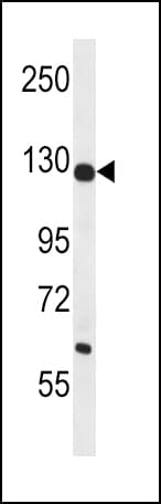 PC / Pyruvate Carboxylase Antibody (aa53-82)