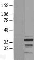 RNF41 Protein (Over-Expression Lysate Myc-DDK (Flag))
