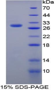 Rat Growth Hormone Receptor / GHR Protein (Recombinant His-T7)