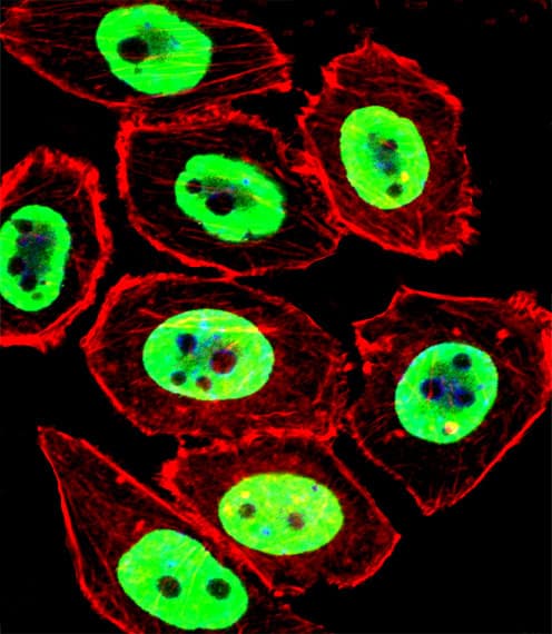 Polyclonal Rabbit anti-Human EWSR1 / EWS Antibody (aa628-656, IF, WB)