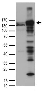FANCI Antibody