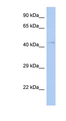 TFDP3 Antibody (aa215-264)