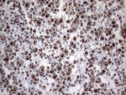 HnRNP A0 Antibody (aa139-183, clone OTI8H8)