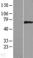 KRT6B / CK6B / Cytokeratin 6B Protein (Over-Expression Lysate Myc-DDK (Flag))