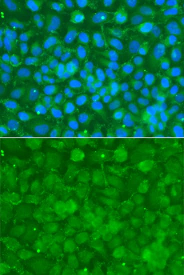 Alpha-1-Antichymotrypsin Antibody