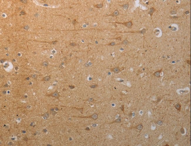 SLC4A7 Antibody