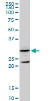 GSTZ1 Antibody (clone 1G12)