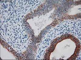 KRT18 / CK18 / Cytokeratin 18 Antibody (clone OTI1E1)
