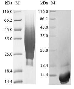 Human CD63 Protein (Recombinant 6His, N-terminus)
