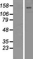 ATP11C Protein (Over-Expression Lysate Myc-DDK (Flag))