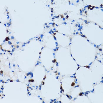 SPN / CD43 Antibody