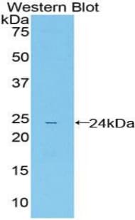 ILT3 / LILRB4 Antibody (aa24-206)