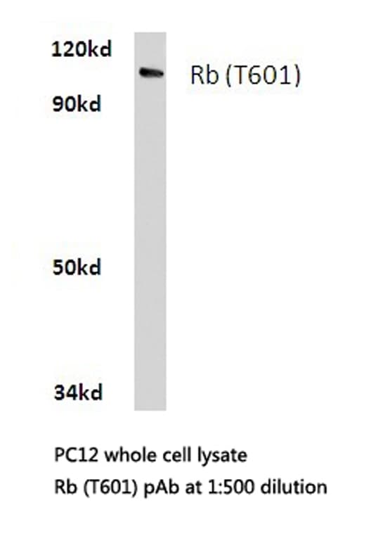 RB1 / Retinoblastoma / RB Antibody (Thr601)