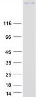 Human TNC / Tenascin C Protein (Recombinant Myc-DDK (Flag))