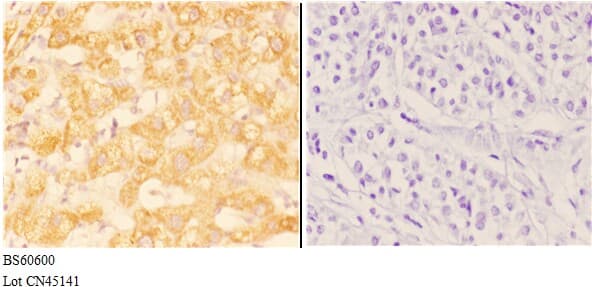 ABHD13 Antibody