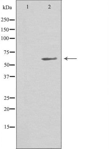 MIA2 Antibody