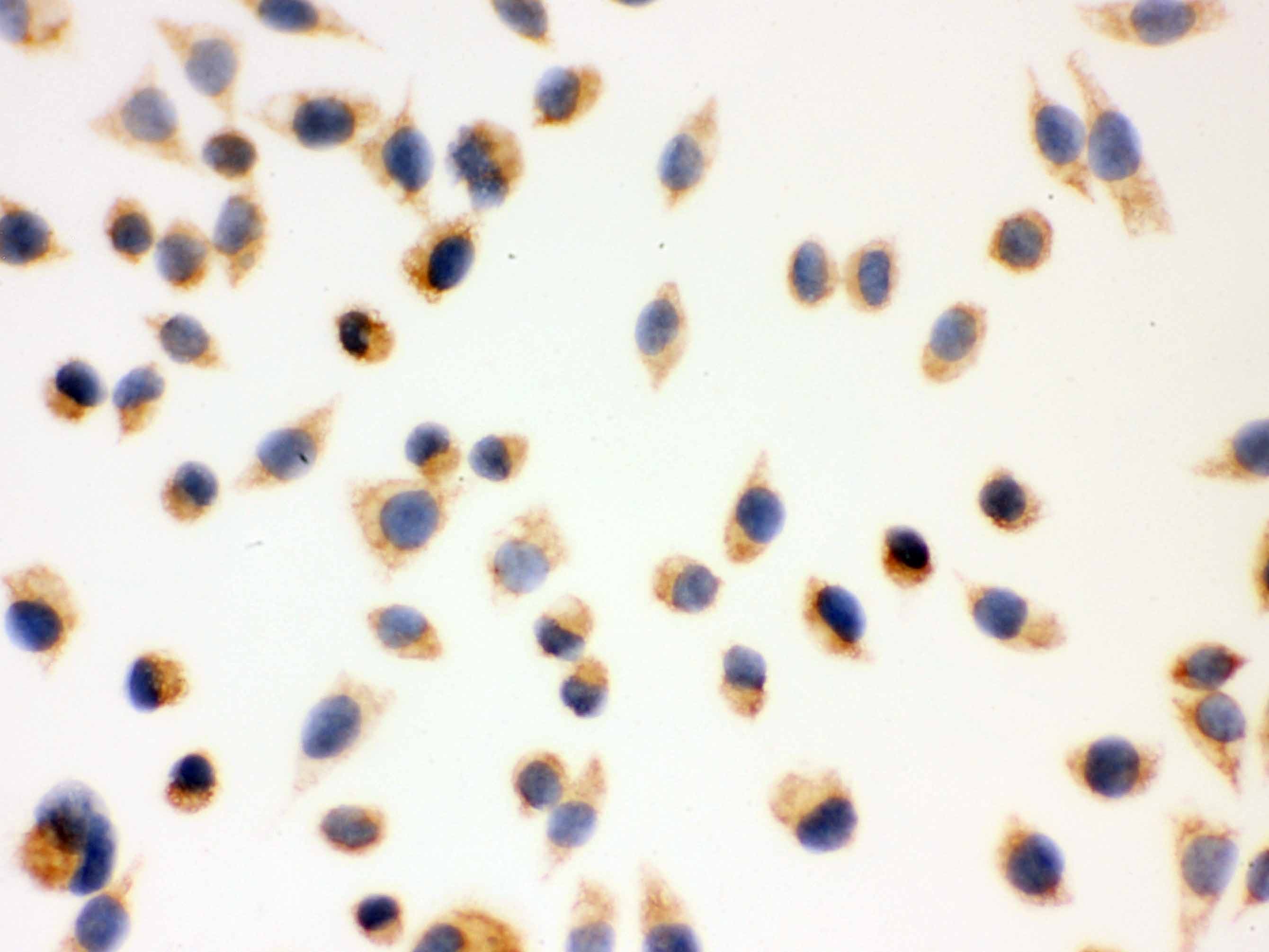 HSD17B10 / HADH2 Antibody (aa48-261)