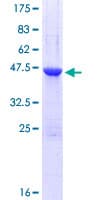 Human UBE2F Protein (Recombinant GST)