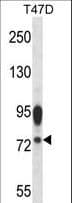 IHC-plus™ GP78 / AMFR Antibody (aa371-400)