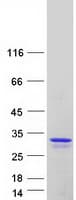 Human TCF21 / Epicardin Protein (Recombinant Myc-DDK (Flag))