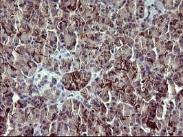 PDGFRB / PDGFR Beta Antibody (clone OTI1E8, Carrier-free)