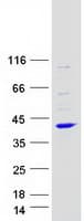 Human ARPC2 / p34-Arc Protein (Recombinant Myc-DDK (Flag))