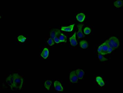 Polyclonal Rabbit anti-Human PIGQ Antibody (IF)