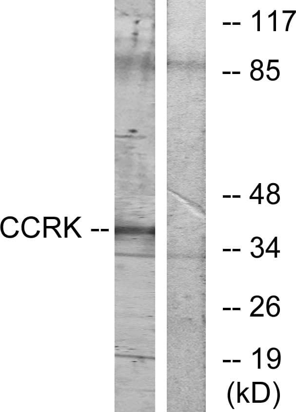 Polyclonal Rabbit anti-Human CDK20 / CCRK Antibody (aa31-80, IF, WB)