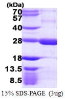 Human RGS5 Protein (Recombinant His)