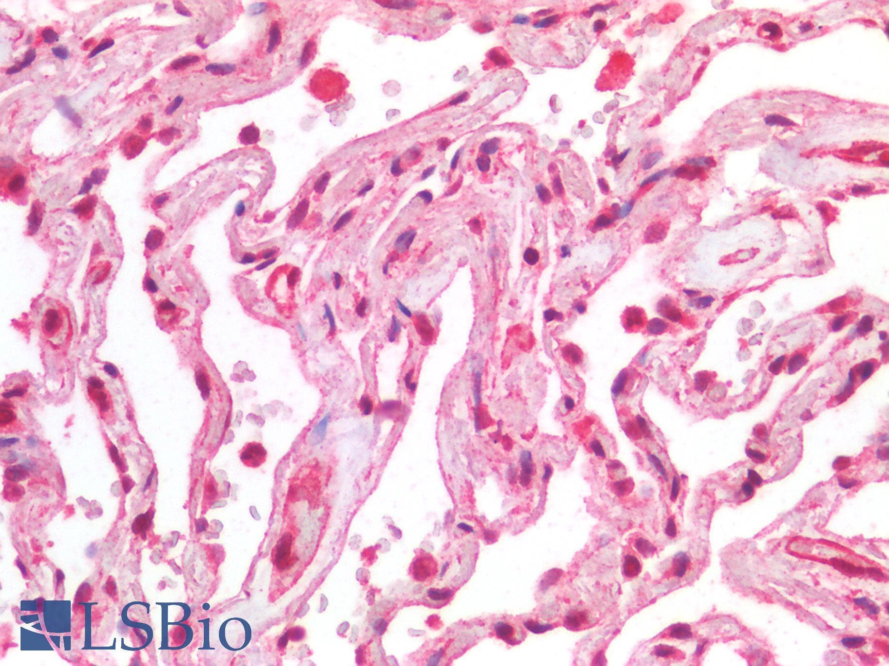 PathPlus™ Polyclonal Rabbit anti-Human ACE2 / ACE-2 Antibody (IHC, IF, WB)