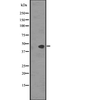 SSTR5 Antibody