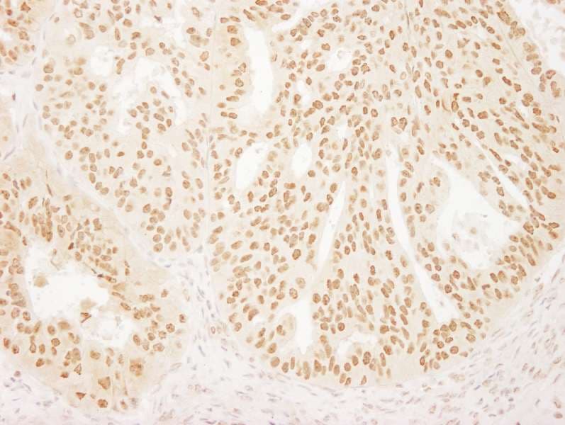 FAC1 / BPTF Antibody (aa1350-1400)