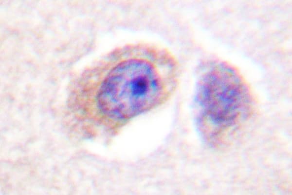 FAK / Focal Adhesion Kinase Antibody (Ile401)
