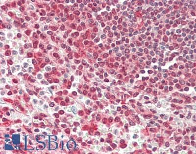 IHC-plus™ RPS3 / Ribosomal Protein S3 Antibody (clone RP159-1)