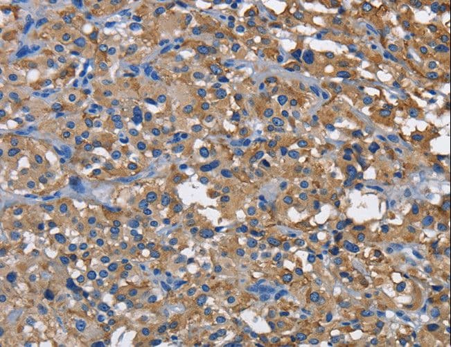 Polyclonal Rabbit anti-Human NK1 / CD160 Antibody (IHC, WB)