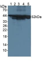KRT18 / CK18 / Cytokeratin 18 Antibody (aa1-423, PE)