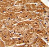 FGF7 / KGF Antibody (aa57-86)