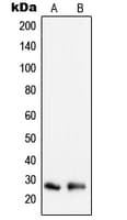 PRDX3 / Peroxiredoxin 3 Antibody (Internal)