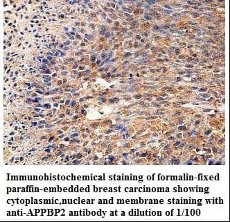 APPBP2 Antibody (aa374-584)