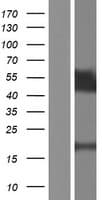 TPRX1 Protein (Over-Expression Lysate Myc-DDK (Flag))