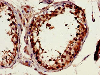FSCN1 / Fascin Antibody