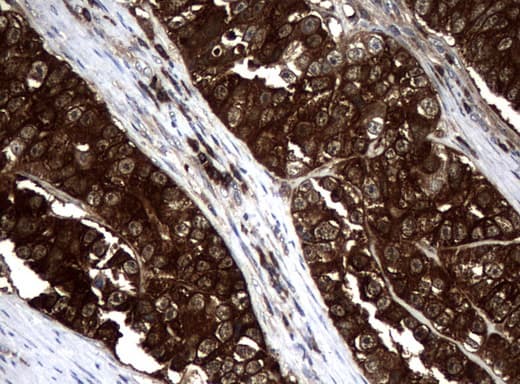 NME1 / NM23 Antibody (clone UMAB93, Carrier-free)
