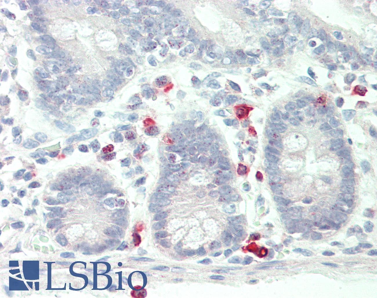 IHC-plus™ Polyclonal Rabbit anti-Human CD40L Antibody (N-Terminus, IHC, WB)