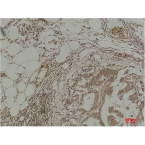 Methyl-Lysine Antibody (clone Mix)
