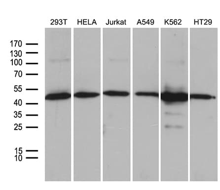 UBAC1 / KPC2 Antibody (clone OTI6E9)
