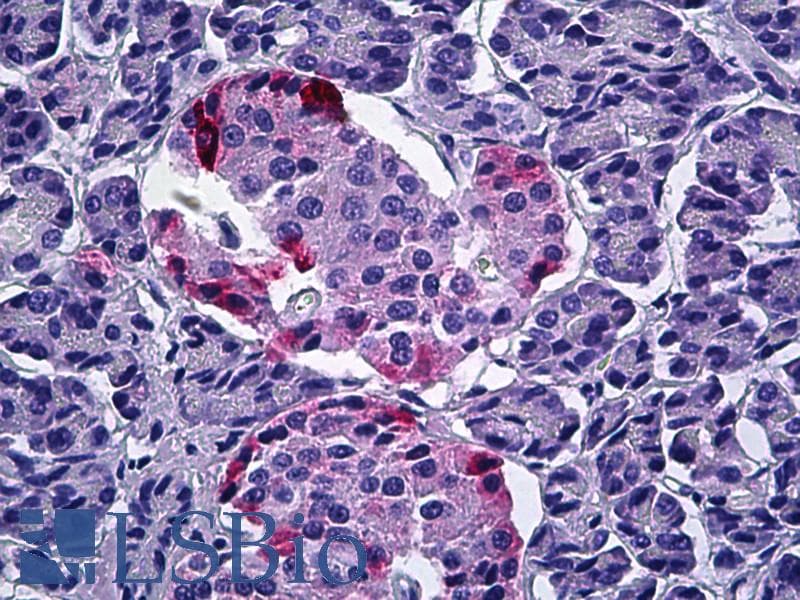 IHC-plus™ Polyclonal Goat anti-Human PPY / Pancreatic Polypeptide Antibody (aa61-73, IHC)