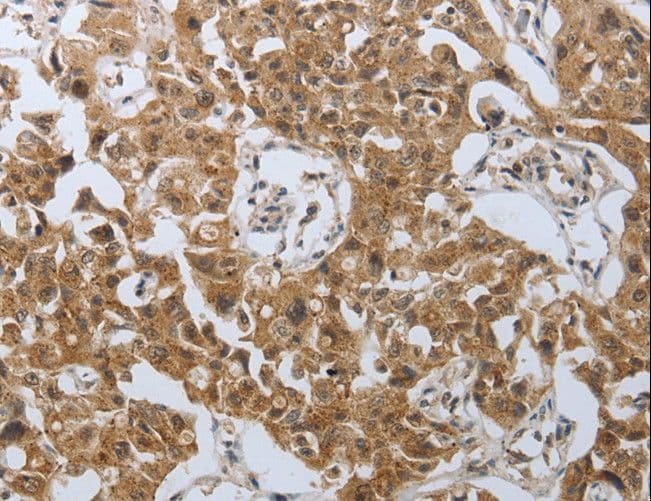 Polyclonal Rabbit anti-Human PSMD6 Antibody (IHC, WB)